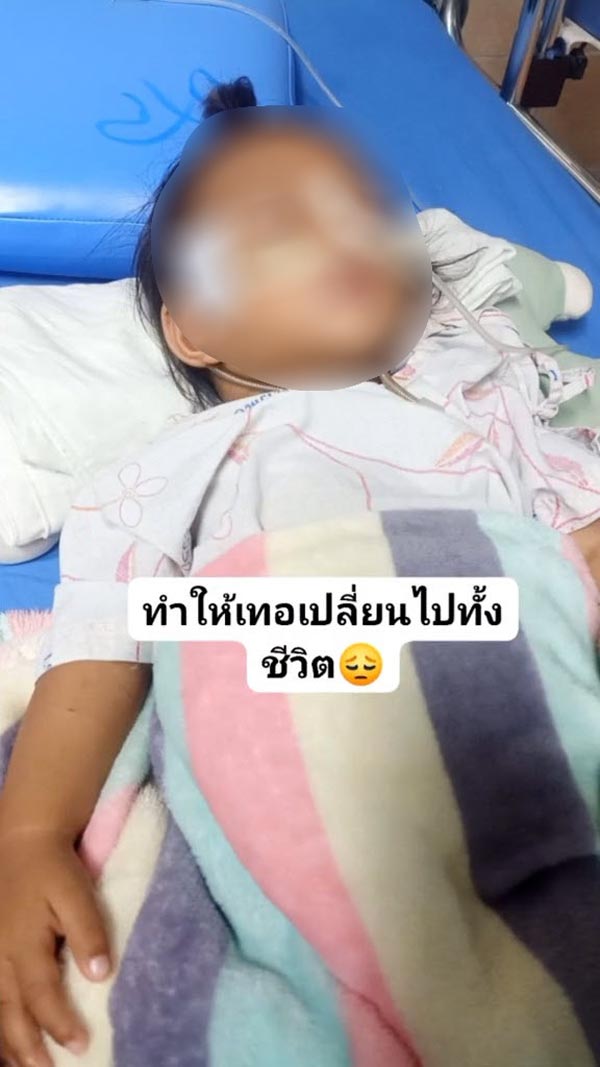 ยุงกัดลูก