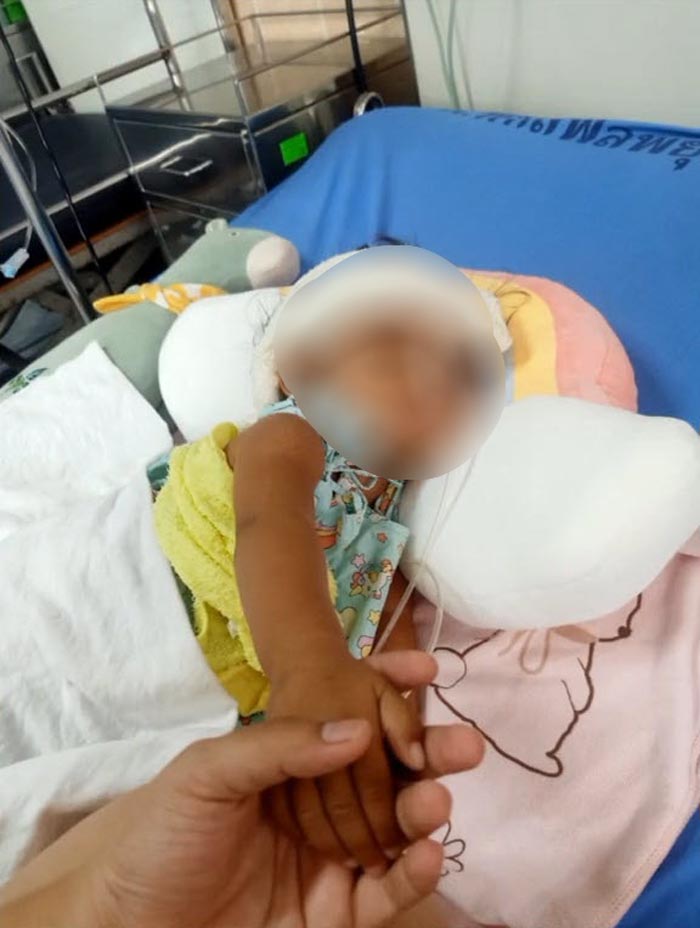 ยุงกัดลูก