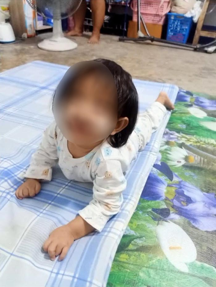 ยุงกัดลูก