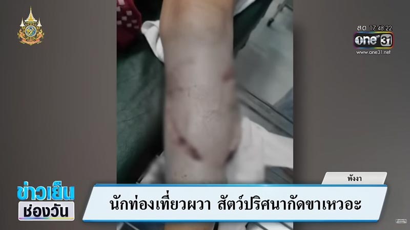 นักท่องเที่ยวถูกฉลามกัด