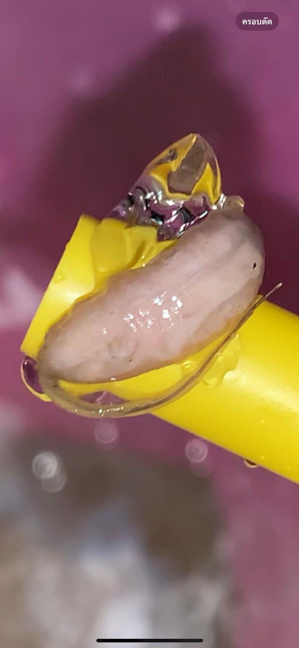 สิ่งสกปรกในน้ำลำไย