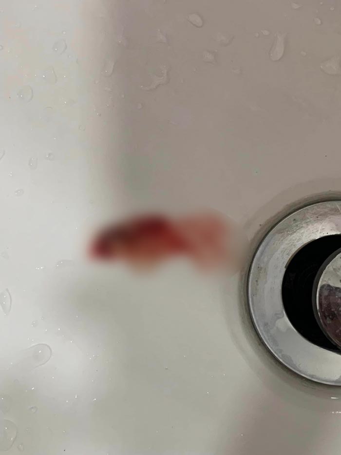 ตำรวจหญิงโดนทำร้ายร่างกาย