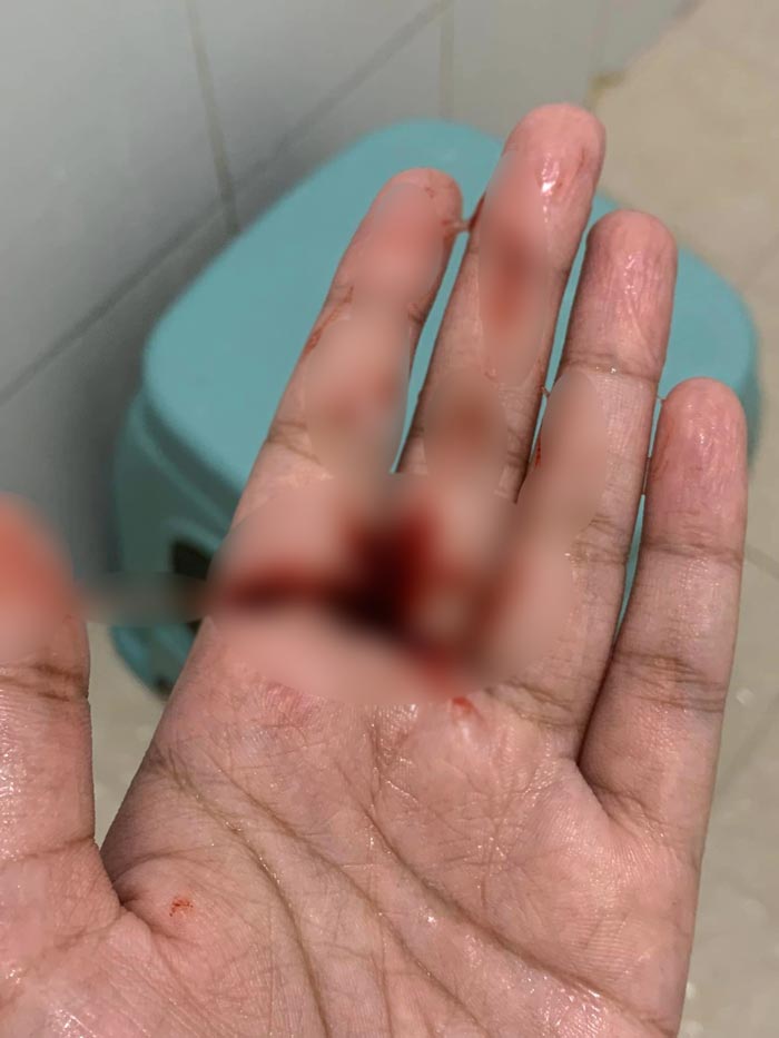 ตำรวจหญิงโดนทำร้ายร่างกาย