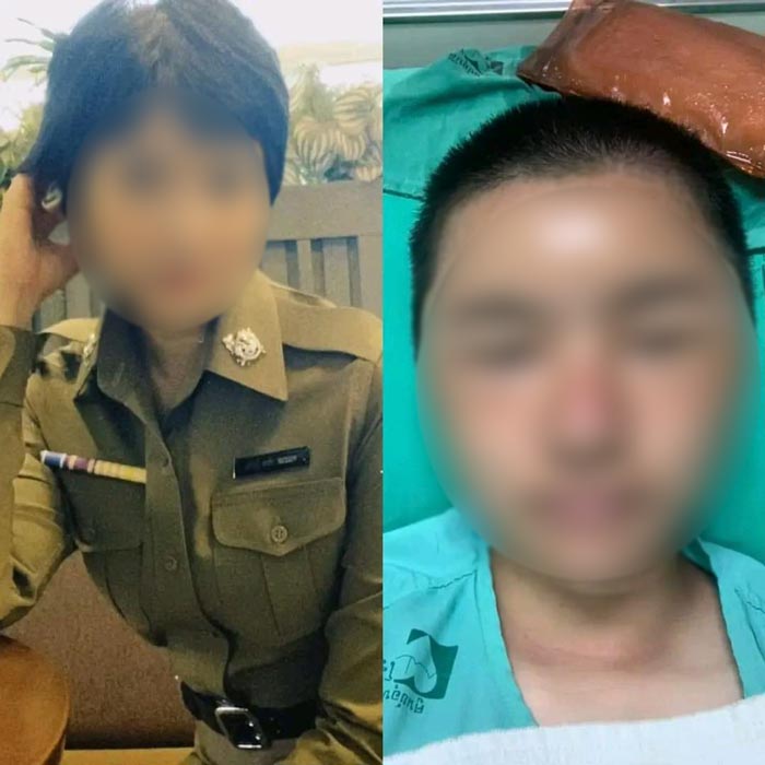 ตำรวจหญิงโดนทำร้ายร่างกาย