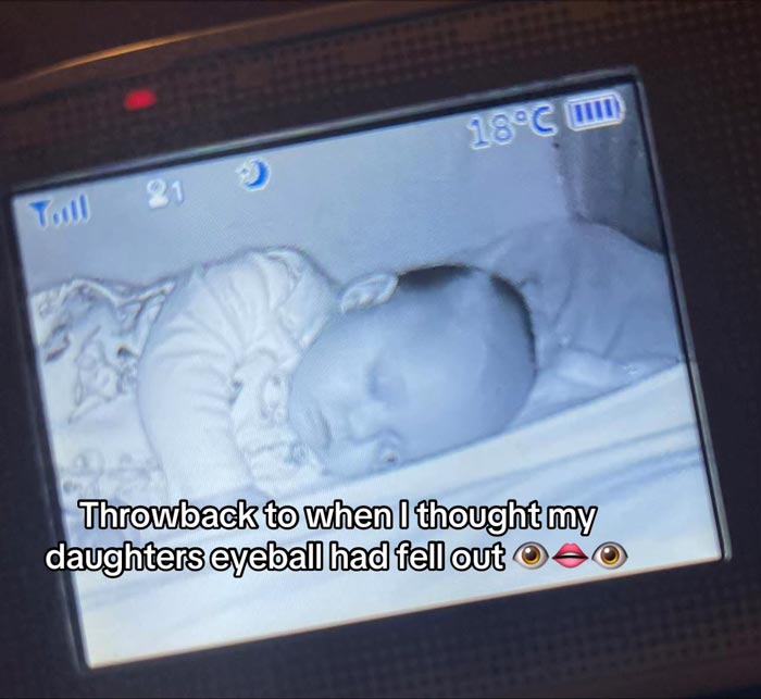 ส่องมอนิเตอร์เจอลูกตาหลุด