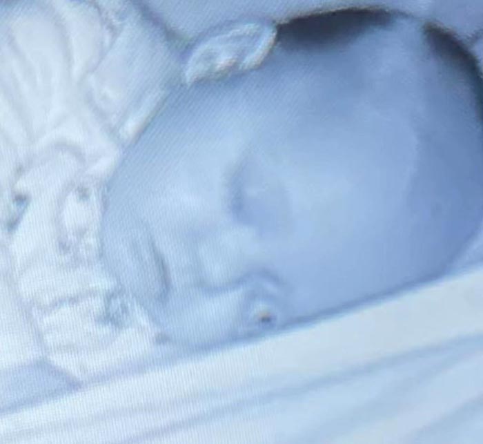 ส่องมอนิเตอร์เจอลูกตาหลุด