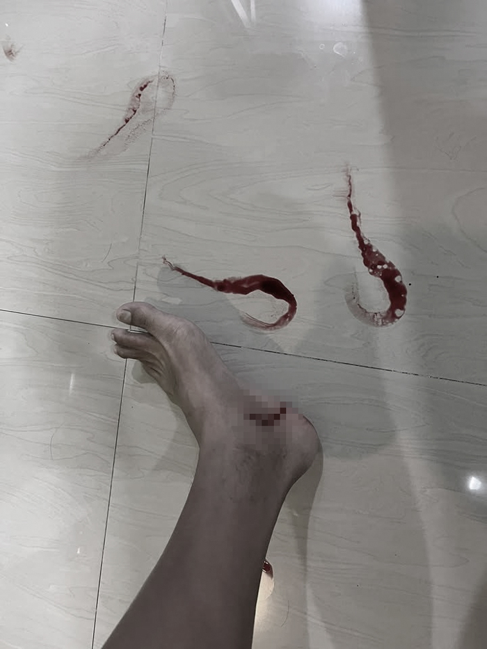 อ่างล้างหน้า ร่วงใส่เท้า