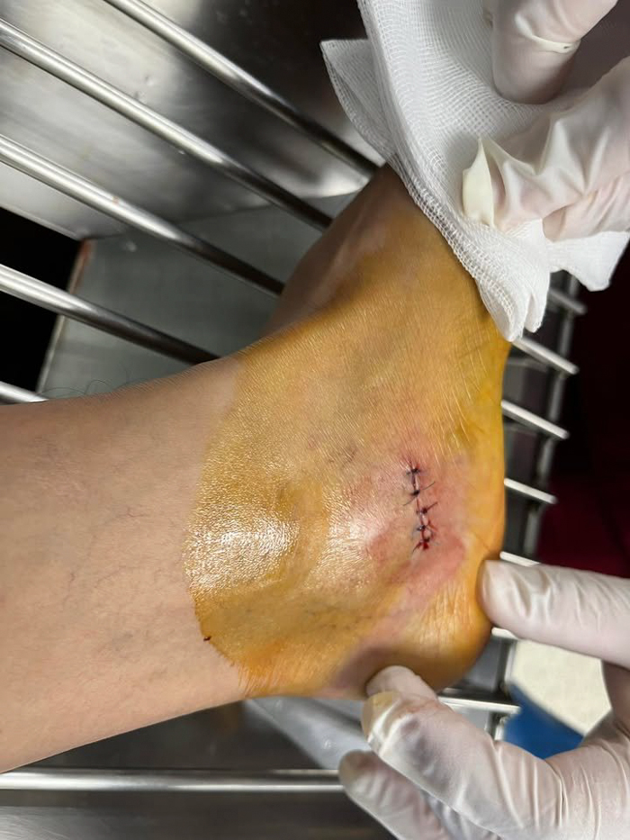 อ่างล้างหน้า ร่วงใส่เท้า