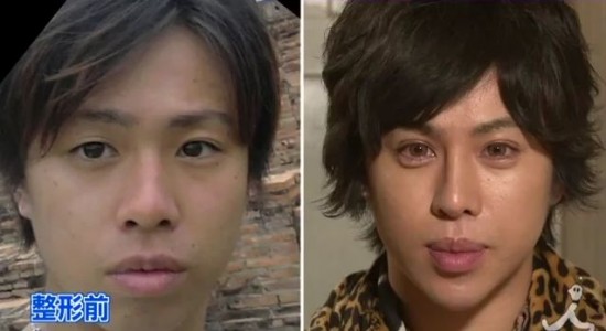 หนุ่มญี่ปุ่นทุ่มเกือบ 5 ล้าน ศัลยกรรมหน้าเหมือนรูปปั้นเดวิด