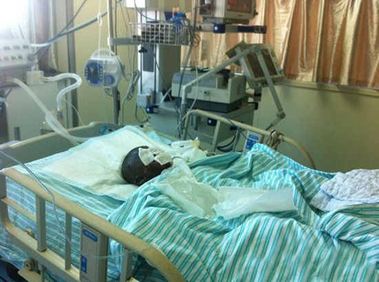 แม่จีนโหด บังคับลูก 4 ขวบกินน้ำมันก่อนจุดไฟเผาพร้อมสามี