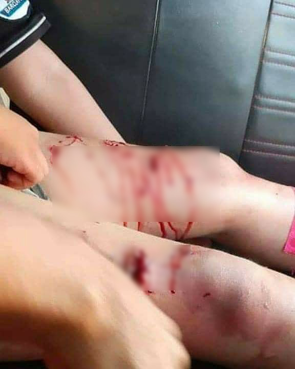 จระเข้กัดเด็ก