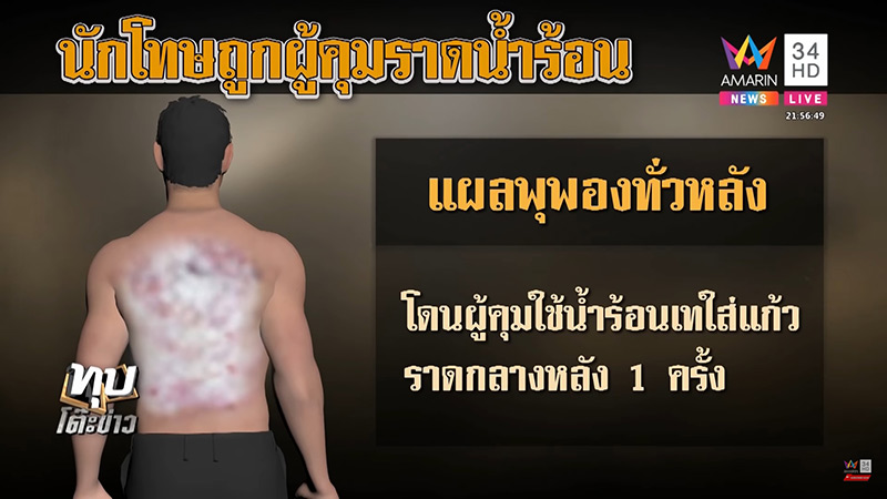 ผู้คุมเทน้ำร้อนใส่นักโทษ