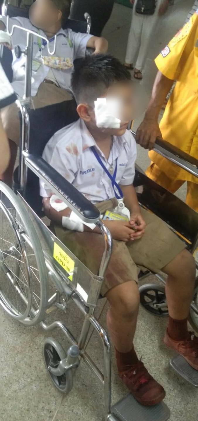  หมากัดเด็กนักเรียน