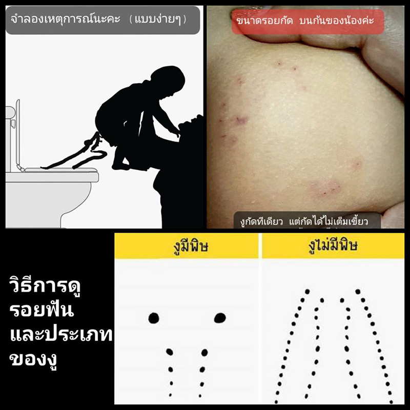 งูในชักโครกกัดก้นเด็ก