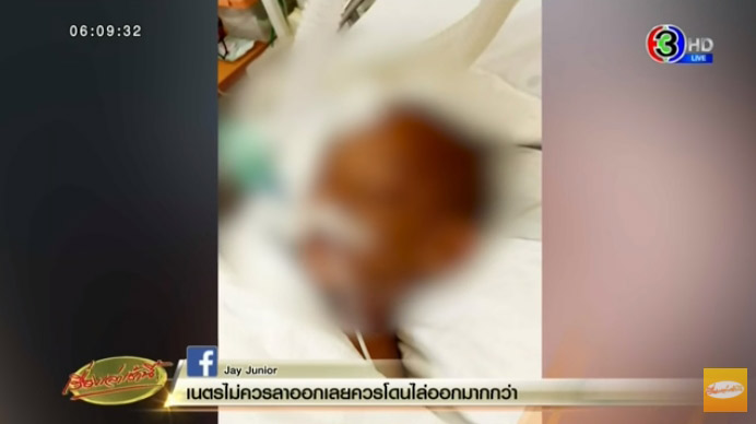 ข่าวพ่อเลี้ยงทำร้ายลูกเลี้ยง