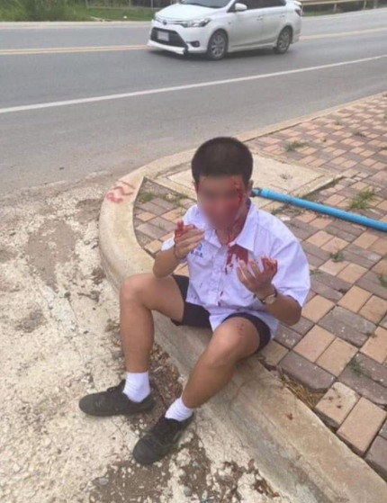 นักเรียนตีกัน