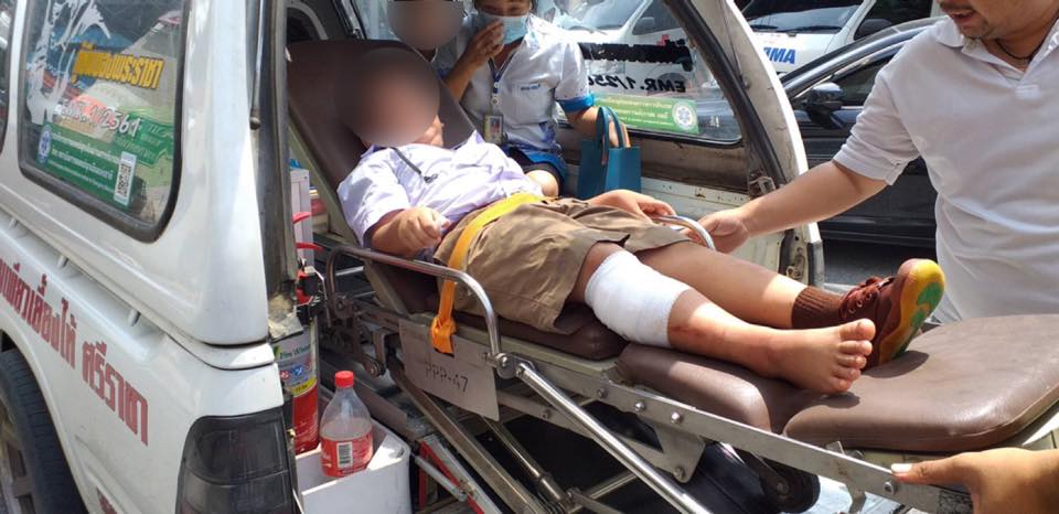  หมากัดเด็กนักเรียน