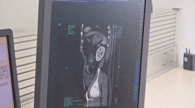 กลั้นฉี่นาน กระเพาะปัสสาวะฉีก 