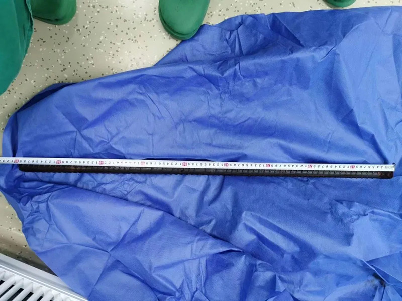 เหล็กเสียบขาหนีบคนงานก่อสร้าง