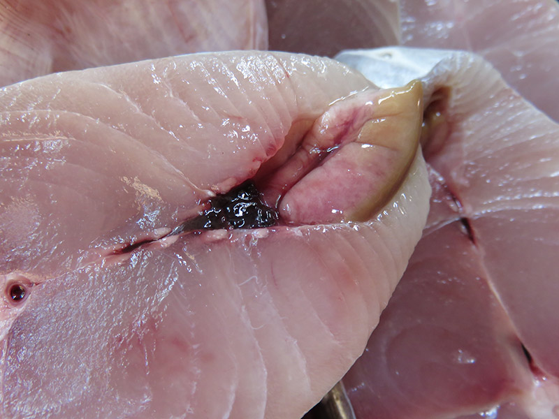 หนุ่มกินปลาดิบ พยาธิยั้วเยี้ยเต็มตับ