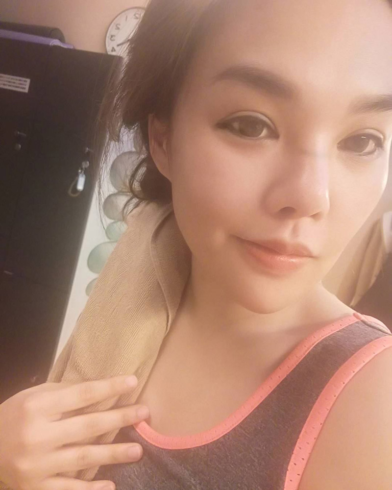 บอนนี่ เอวิต้า หลอ ศัลยกรรมหน้าอกตาย