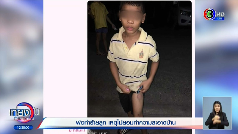 พ่อทำร้ายลูก