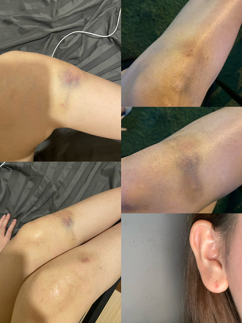 แฉนักร้องวงดัง ทำร้ายแฟน 