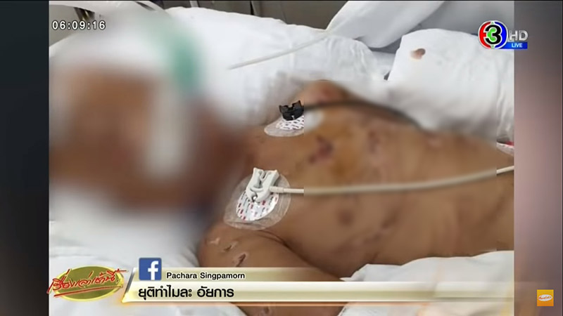 ข่าวพ่อเลี้ยงทำร้ายลูกเลี้ยง