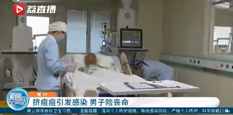 บีบสิว ป่วยหนักปางตาย