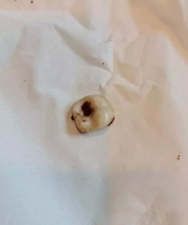 สตาร์บัคส์ ชี้แจง ฟันในขนมบราวนี่