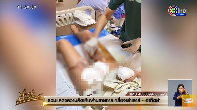 หม้อจิ้มจุ่มตกใส่ตัวแผลเหวะหวะ