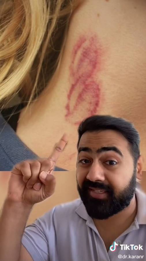 สาวโดนดูดต้นคอ กลายเป็นอัมพาต 