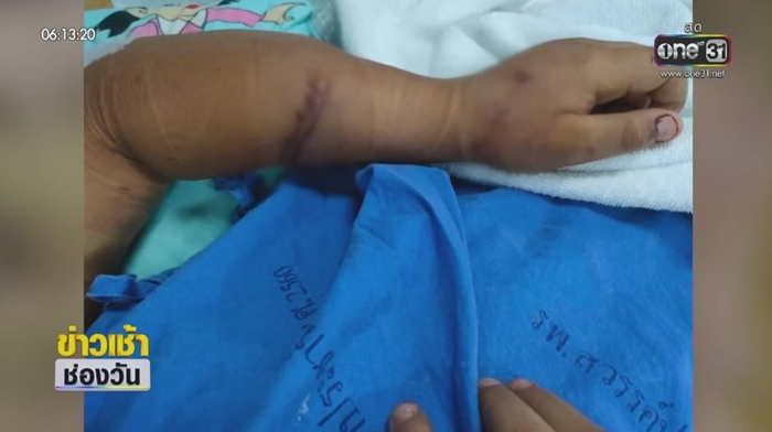 จระเข้กัดเด็ก