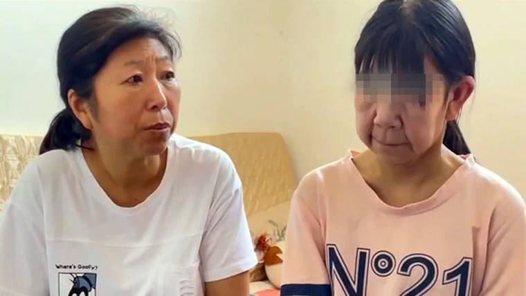 ป่วยแปลก อายุ 14 แต่หน้าแก่เหมือนอายุ 70