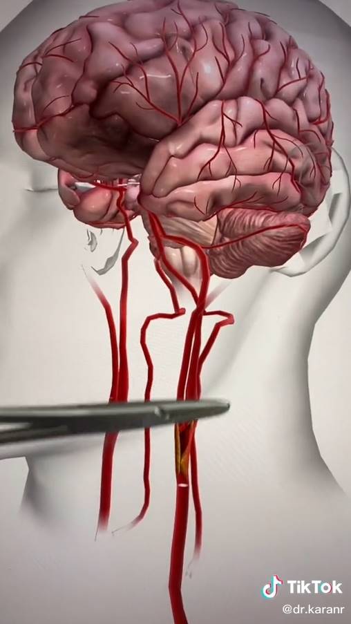 สาวโดนดูดต้นคอ กลายเป็นอัมพาต 