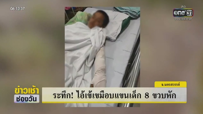 จระเข้กัดเด็ก