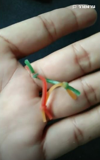 ยางรัดแกงสวมปลายอวัยวะเพศ