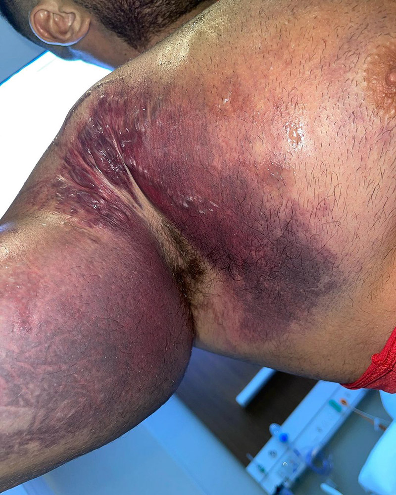 ยกน้ำหนัก กล้ามเนื้อบิด