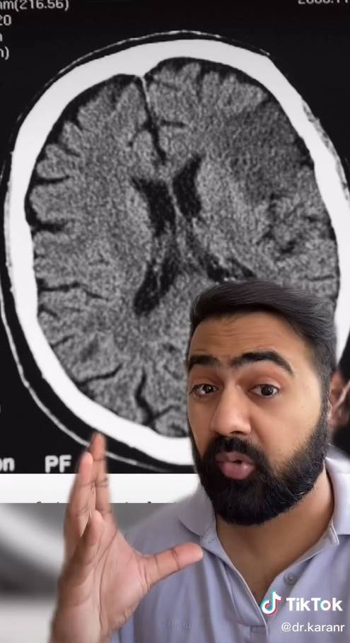 สาวโดนดูดต้นคอ กลายเป็นอัมพาต 