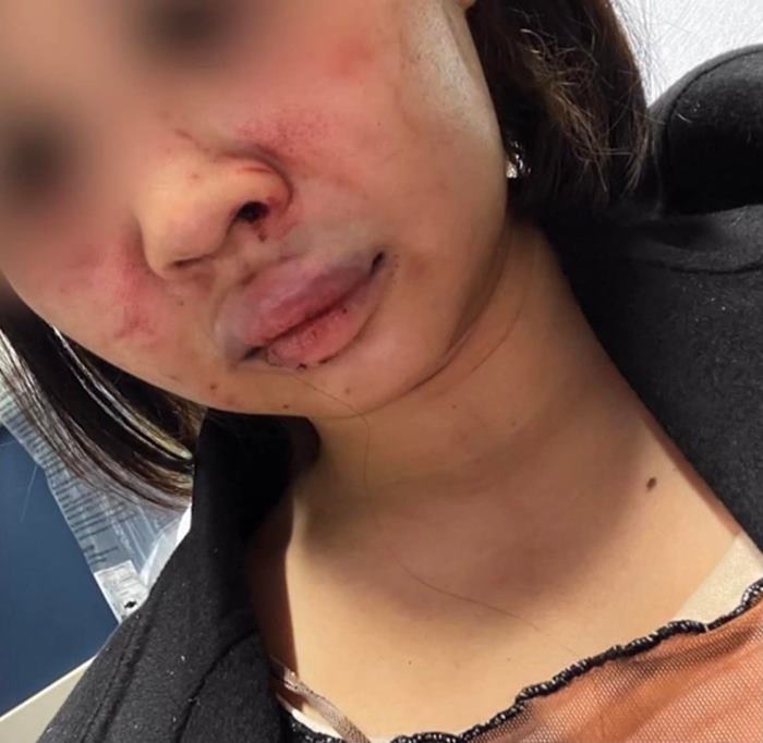 สาวไทยถูกทำร้ายในนิวยอร์ก