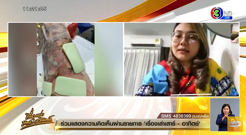 หม้อจิ้มจุ่มตกใส่ตัวแผลเหวะหวะ