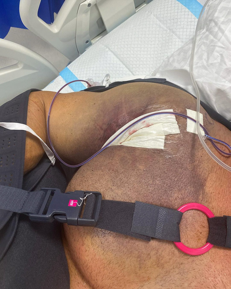 ยกน้ำหนัก กล้ามเนื้อบิด