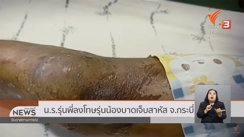 รุ่นพี่เอาซีม่าราดน้อง