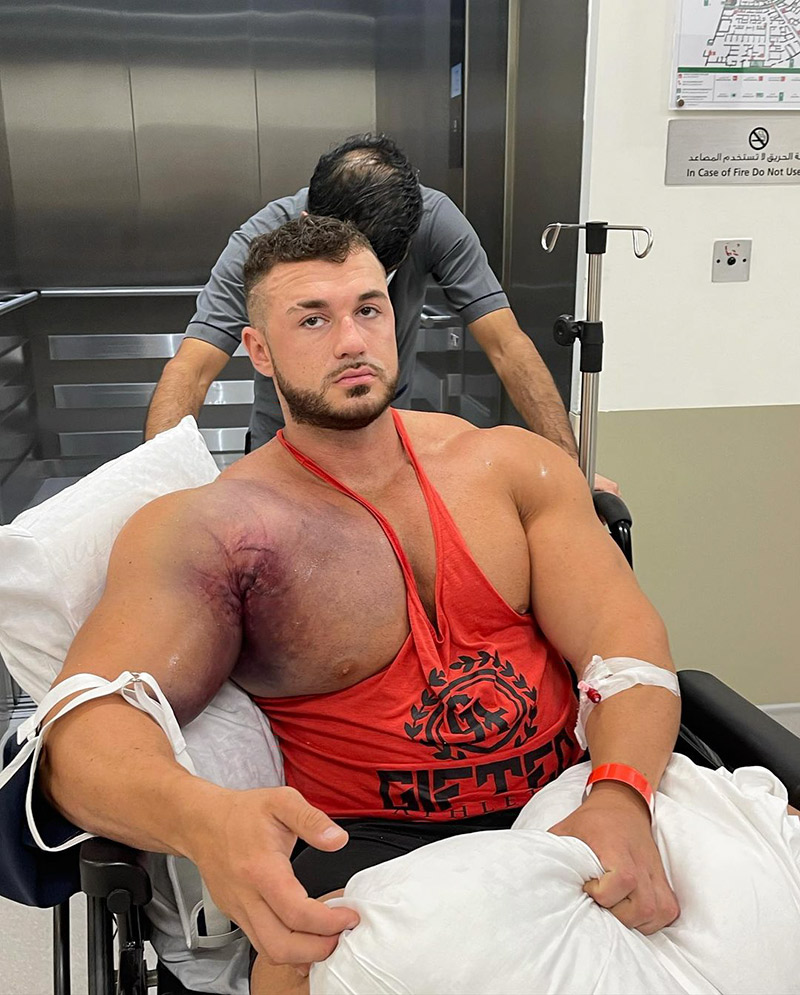 ยกน้ำหนัก กล้ามเนื้อบิด