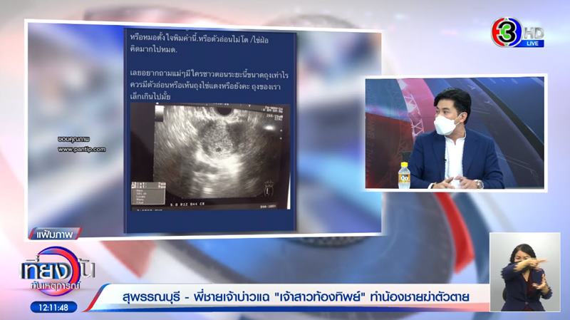 เจ้าบ่าวยิงตัวตายวันแต่งงาน 