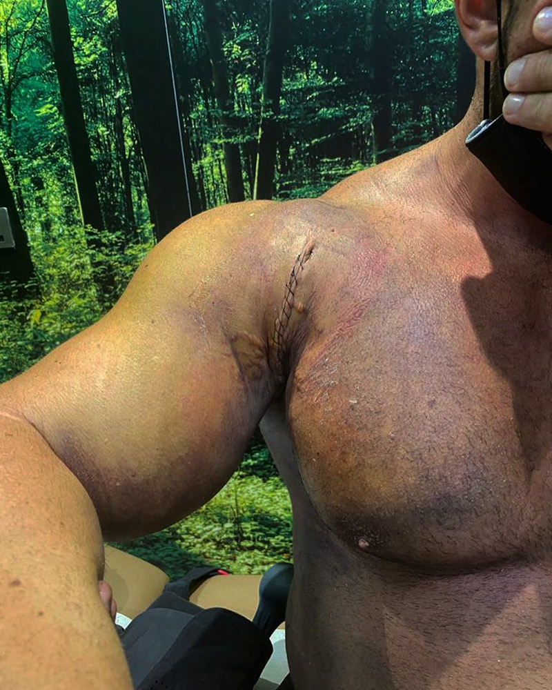 ยกน้ำหนัก กล้ามเนื้อบิด