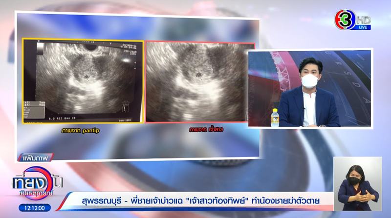 เจ้าบ่าวยิงตัวตายวันแต่งงาน 