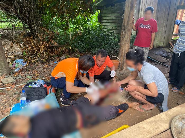 มือถือระเบิดใส่ขาเหวอะ 