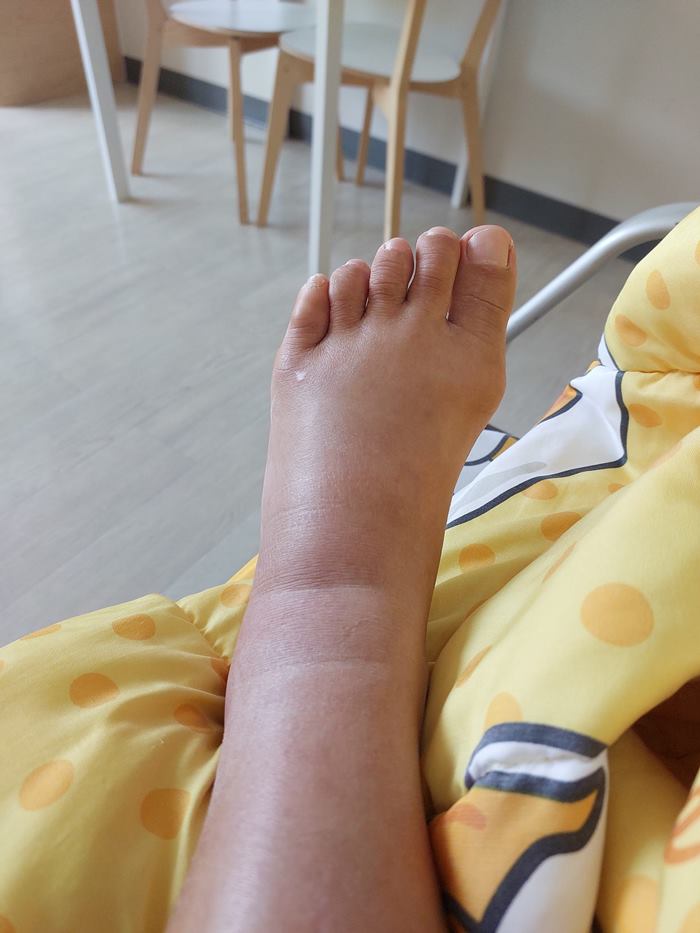 งูกัดในห้าง