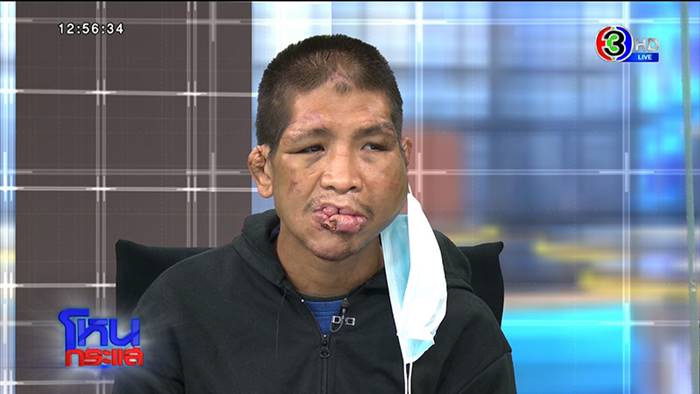 เจ๊กั้งทำร้ายน้องฟ้า ศาลสั่งจำคุก 14 ปี 6 เดือน